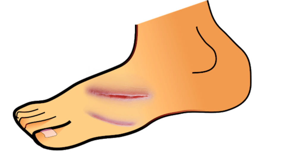 Surviving Psychopathic Parenting (Part 15):  Learning to walk&nbsp;small.